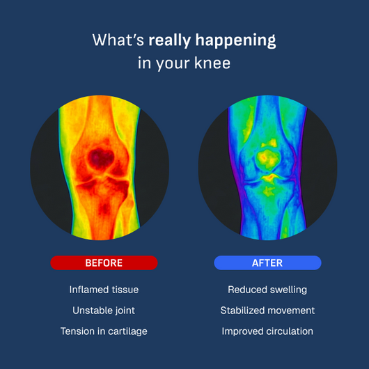 Mobilitee™ - Smart Knee Brace